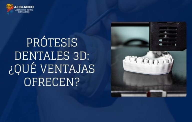 Prótesis Dentales 3D