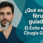 ¿Qué es una férula guiada? El Éxito en una Cirugía Guiada