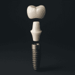 Selección de Pilares para Implantes
