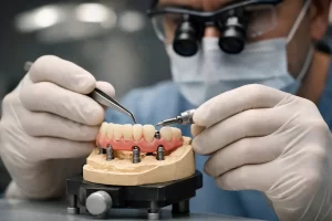 pasividad en implantes