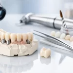estetica dental en protesis
