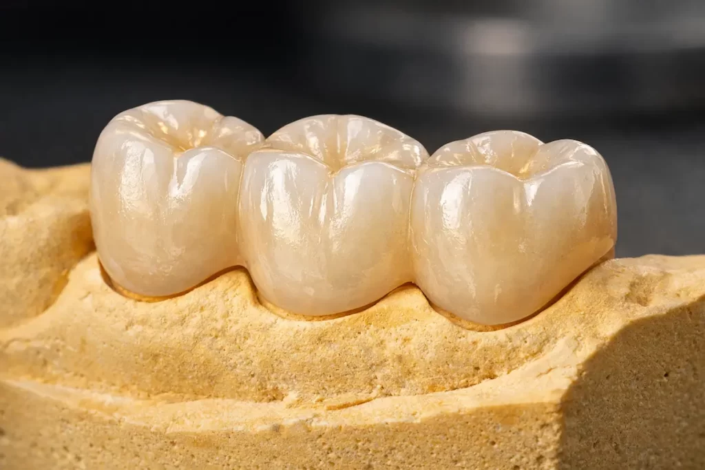laboratorio dental en malaga