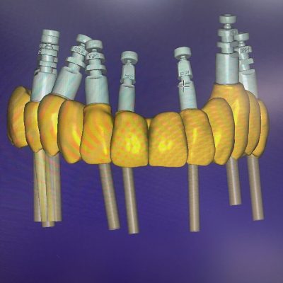Laboratorio Protesis Dental